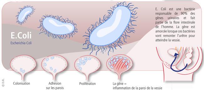 Infection urinaire à E.coli